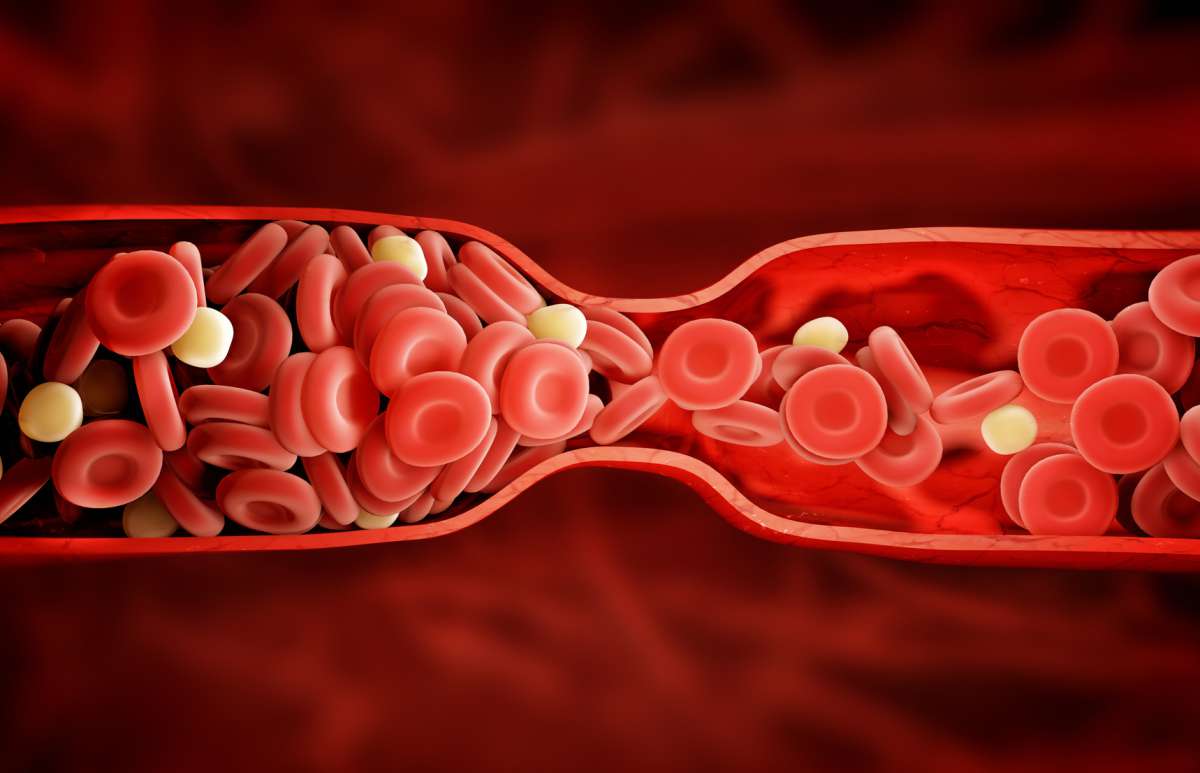 Cholesterol - zdjęcie partnera